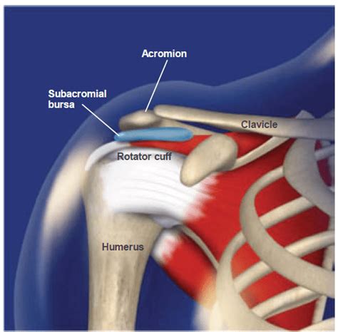 Shoulder Impingement And Subacromial Bursitis Physiotherapy Manly