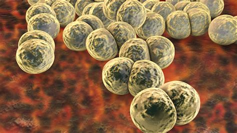 Untreatable Gonorrhea Rising Globally The Scientist Magazine®