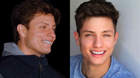 Does Matt Rife Have Fake Teeth Before And After Pictures Show Stark