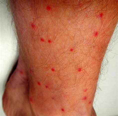 Tiny Red Dots On Leg Pictures Photos