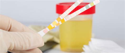 Significance Of Urine Test During Pregnancy