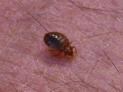 What Do Bed Bug Bites Look Like Pictures Guide Pestseek