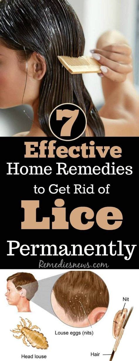 7 Effective Home Remedies To Get Rid Of Lice Permanently In One Day
