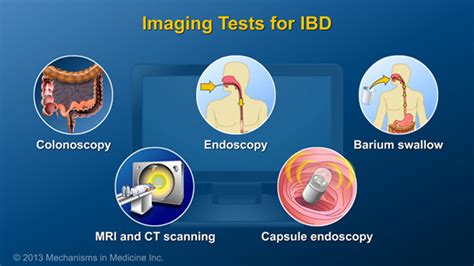 Slide Show Diagnosing Ibd
