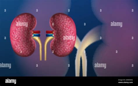 Kidney Disease Human Anatomy Care Kidney Cancer Realistic Vector
