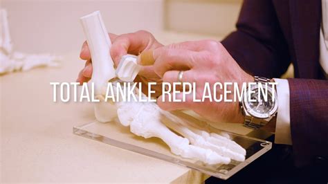 Ankle Replacement Surgery Youtube