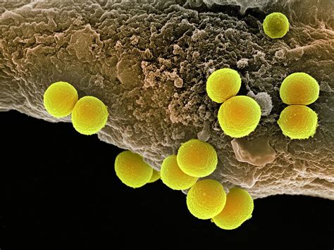 Staphylococcus Aureus Bacteria Sem Photograph By
