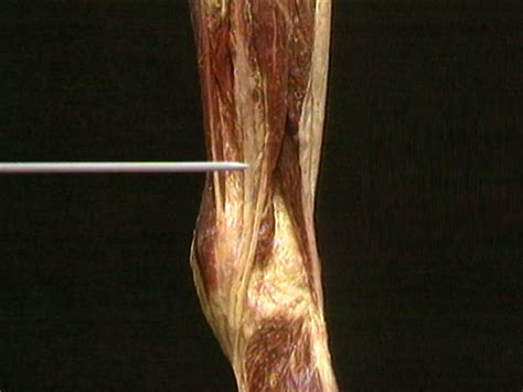 Diagram The Muscles Around Knee Diagram Mydiagram Online