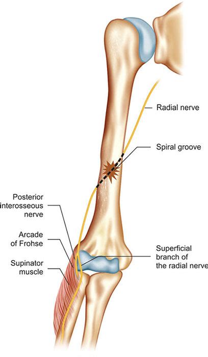 Radial Groove Radial Nerve