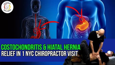 Costochondritis And Hiatal Hernia Relief In 1 Nyc Chiropractor Visit