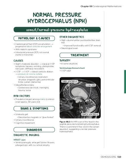 Normal Pressure Hydrocephalus Osmosis