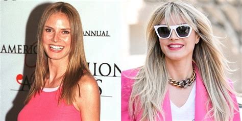 Has Heidi Klum Had Plastic Surgery Nose And Face Before And After