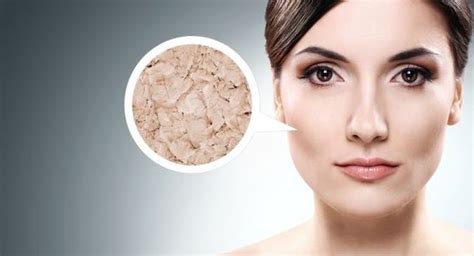 Dry Skin On Your Face Apply These 5 Moisturising Face Packs Read