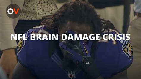Brain damage was diagnosed in 87 percent of donated brains of 202 football players, including all but one of 111 brains of national football league athletes. NFL Acknowledges Link Between Football And Brain Damage ...
