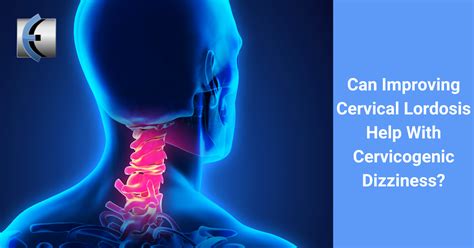 Research Can Improving Cervical Lordosis Help With Cervicogenic