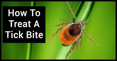 Your Complete Guide To Treating A Tick Bite