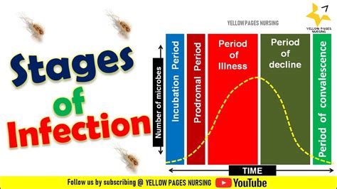 What Are The 4 Stages Of Infection Tipseri