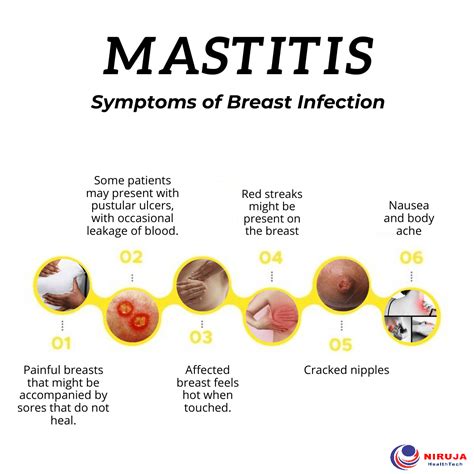 Mastitis Symptoms Of Breast Infection