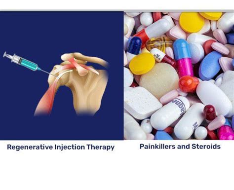 Prolotherapy Vs Other Pain Treatments Which Is Right For You