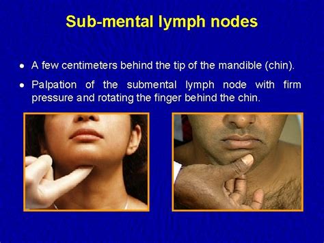 Lymph Nodes Examination Examination Of The Lymphatic System