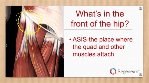 Obturator internus, superior and inferi… what muscle attaches at 1. Pain in the Front of the Hip: What's Causing It? - Regenexx®