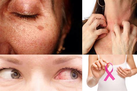 10 Harmful Side Effects Of Using Makeup Cosmetics Mpmania