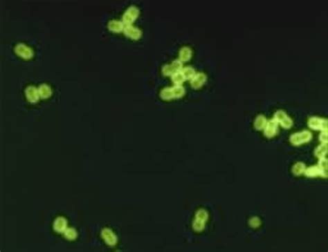 Bakteri Diplococcus Pneumoniae Menyebabkan Penyakit Apa