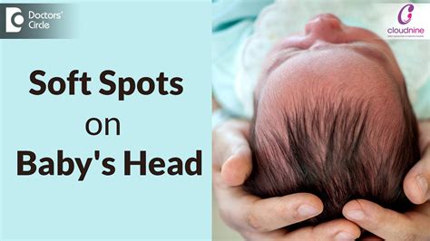 Soft Spots On Newborn Baby Head Fontanelle Dr Seema Gaonkar Of Cloudnine Hospitals Doctors