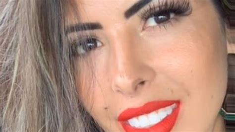 Truth about Jaqueline Alarcãos viral teeth transformation in TikTok