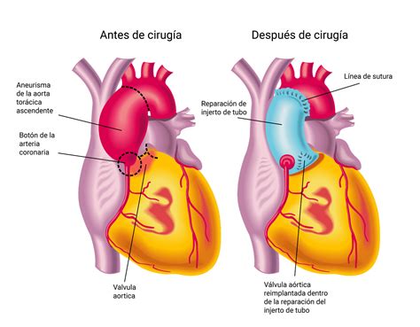 Cirugía Cardiovascular Centro Médico Abc