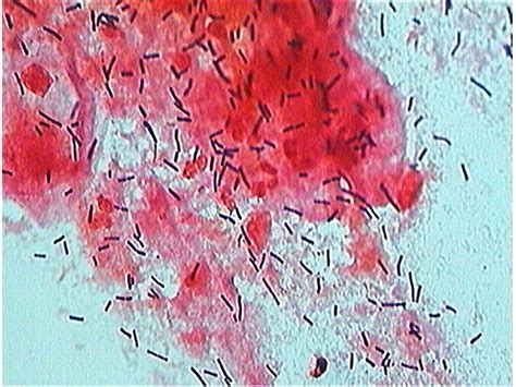 Filebacteria Gram Stained Vaginal Smear 06 Embryology