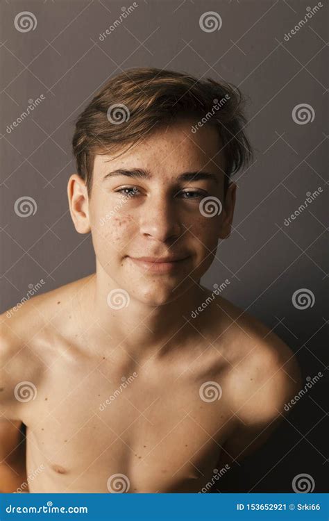 Portrait Of Young Boy With Acne Problems Stock Image Image Of