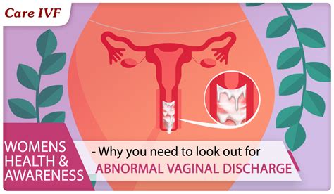 Vaginal Discharge Causes Treatment Prevention Self Help