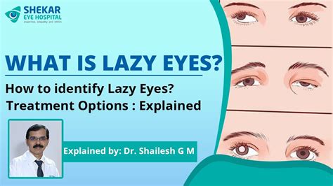 How To Identify Lazy Eyes Treatment Options Explained Youtube