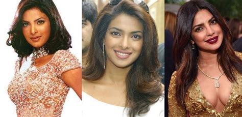 Priyanka Chopra Plastic Surgery Before And After Pictures 2020