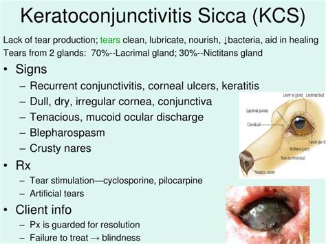 Ppt Ophthalmic Diseases Powerpoint Presentation Id998440
