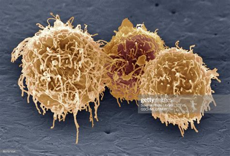 White Blood Cells Scanning Electron Microscope Stock Foto Getty Images