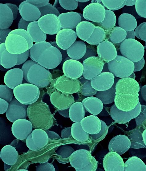 Staphylococcus Haemolyticus Photograph By Dennis Kunkel Microscopy
