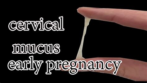Cervical Mucus In Early Pregnancy Youtube