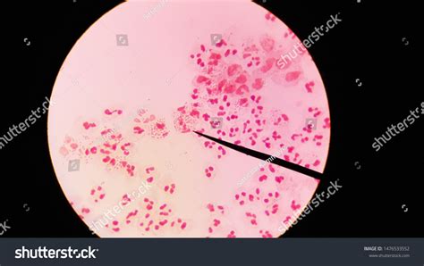 Gram Stain Neisseria Gonorrhoeae Urethral Discharge Foto De Stock Shutterstock