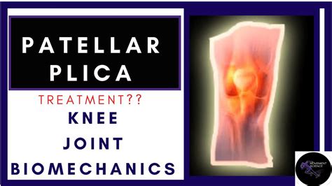 Patellar Plica Syndrome Treatment Biomechanics Explained