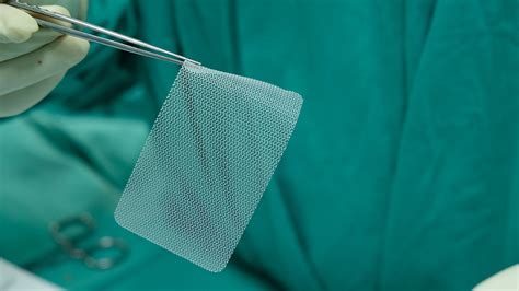 Transvaginal Mesh Lawsuits What Is A Transvaginal Surgical Mesh