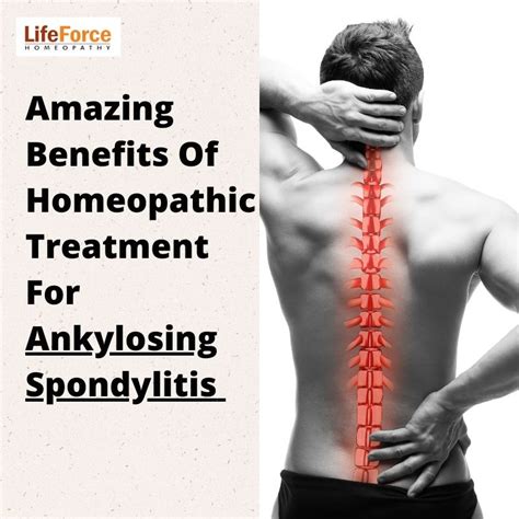 Amazing Benefits Of Homeopathic Treatment For Ankylosing Spondylitis