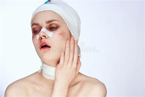 Emotional Woman Facial Injury Health Problems Bruises Pain Close Up