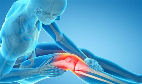 Beyond Pain Relief Total Knee Replacement Surgery Nih Medlineplus