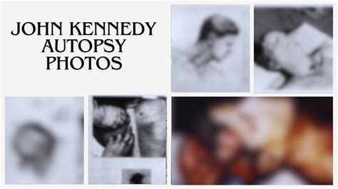 John Kennedy Autopsy Photos Who Killed Him And Why Venture Jolt