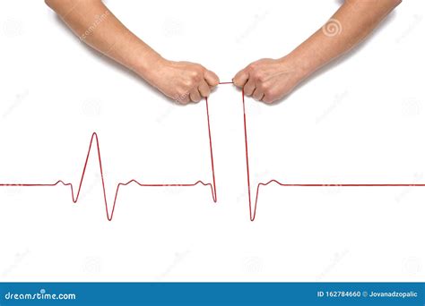 Heartbeat Rhythm Graph On A White Background Electric Cardiogram