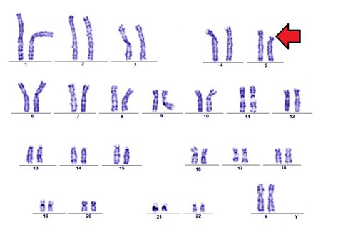 Curiosidades CientÍficas Mutaciones Cromosómicas Y Genómicas