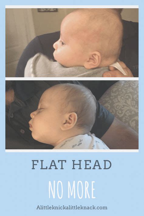 Arent Heads Supposed To Be Round What To Do If You Notice Your Baby