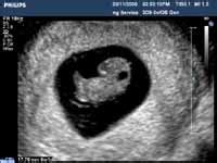 They wait for dating a week at 7 weeks. Early Pregnancy Assessment and Dating